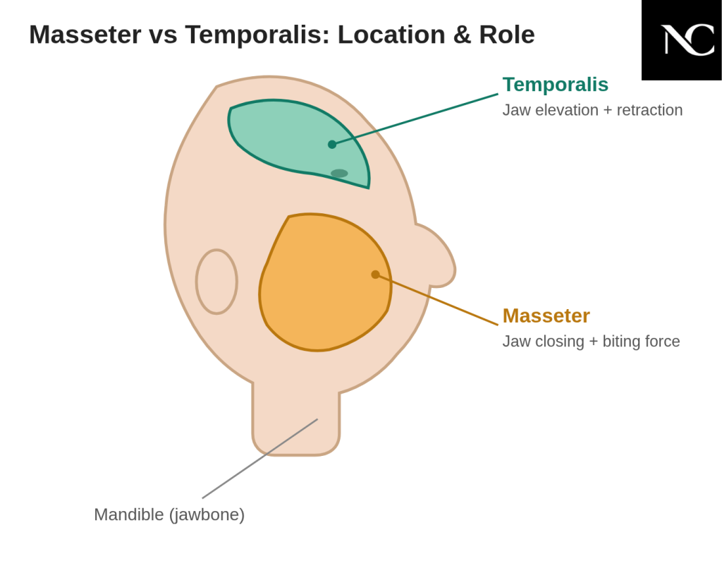 Masseter vs temporalis diagram